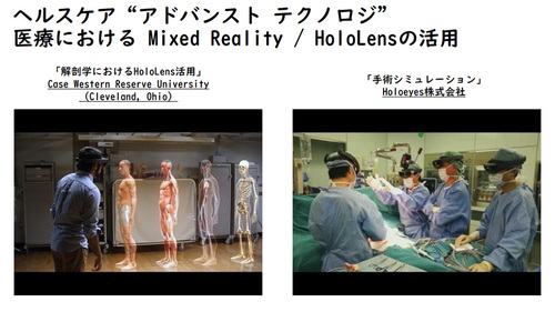 図1：Hololensを医療分野に応用した事例（出典：日本マイクロソフト）